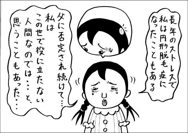 ぶり子さんは、父親から受けるストレスで、円形脱毛症になったこともあった