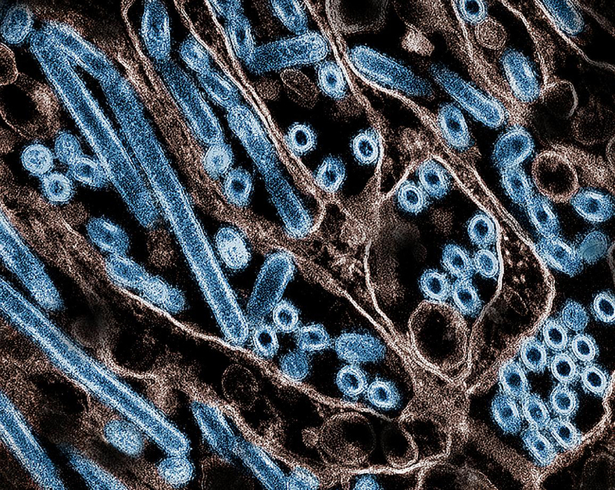 高病原性鳥インフルエンザ（Ｈ５Ｎ１型）ウイルス粒子（青く着彩）の電子顕微鏡像＝米疾病対策センター（ＣＤＣ）、米国立アレルギー・感染症研究所提供（ＡＦＰ時事）