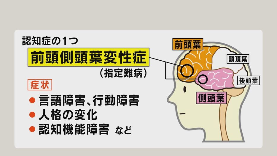 修さんが診断を受けた前頭側頭葉変性症とは