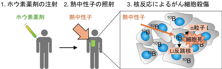 BNCTの概要。ボロノフェニルアラニン（BPA）を注射して加速器などから生じる熱中性子を照射し、BPAをふくんだ細胞を殺傷する（東京大学の野本貴大准教授提供）