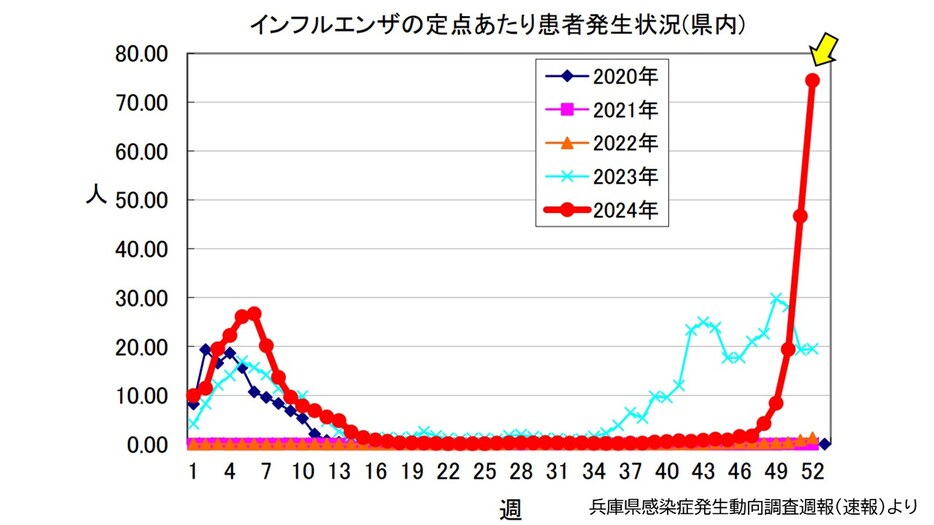 MBSニュース