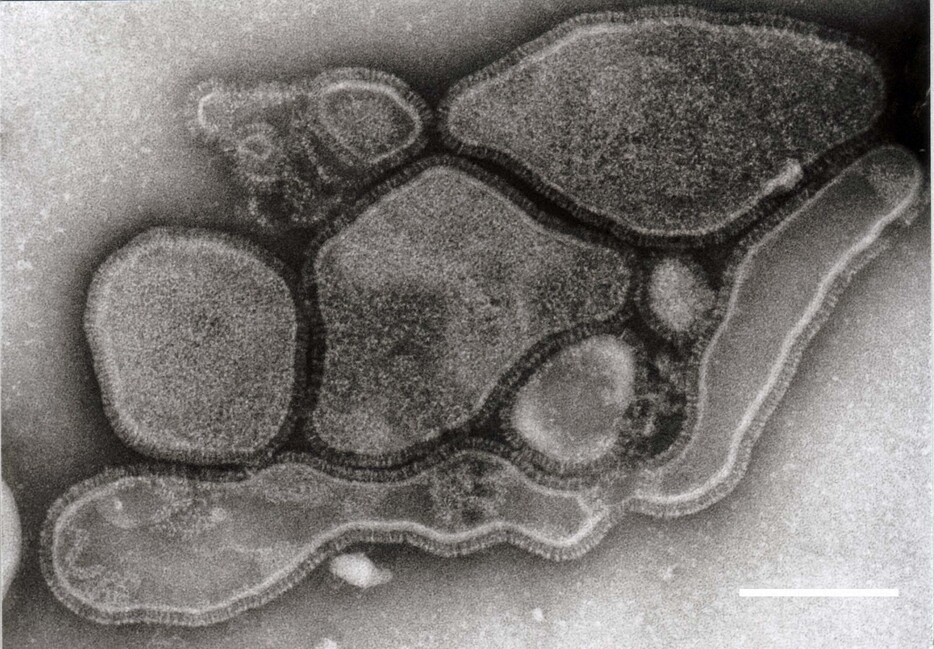 ヒトメタニューモウイルスの電子顕微鏡写真＝地方独立行政法人「大阪健康安全基盤研究所」提供