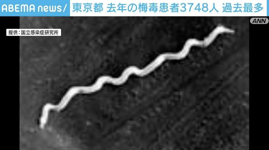 梅毒の患者報告数が過去最多に