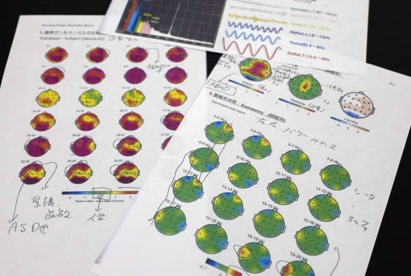 「ＱＥＥＧ」と呼ばれる脳波検査の結果レポートのコピー（患者提供）