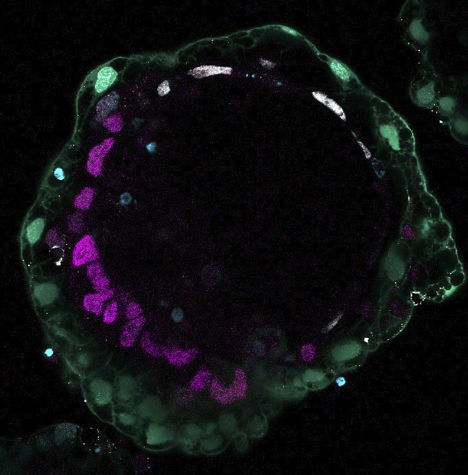 iPS細胞などから作製した培養9日目の人の胚モデルの顕微鏡写真（京都大提供）