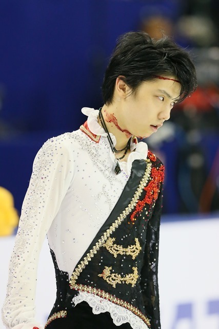 写真特集]羽生結弦が衝突し流血…4分半を演じきって堂々2位 (Yahoo