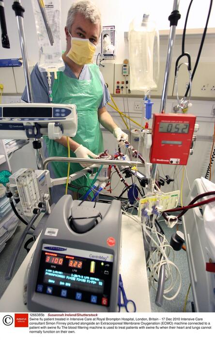 [イメージ]ECMO（エクモ＝体外式膜型人工肺）（写真：REX/アフロ）