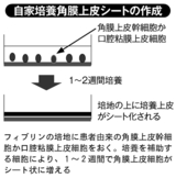 自家培養角膜上皮シートの作成過程