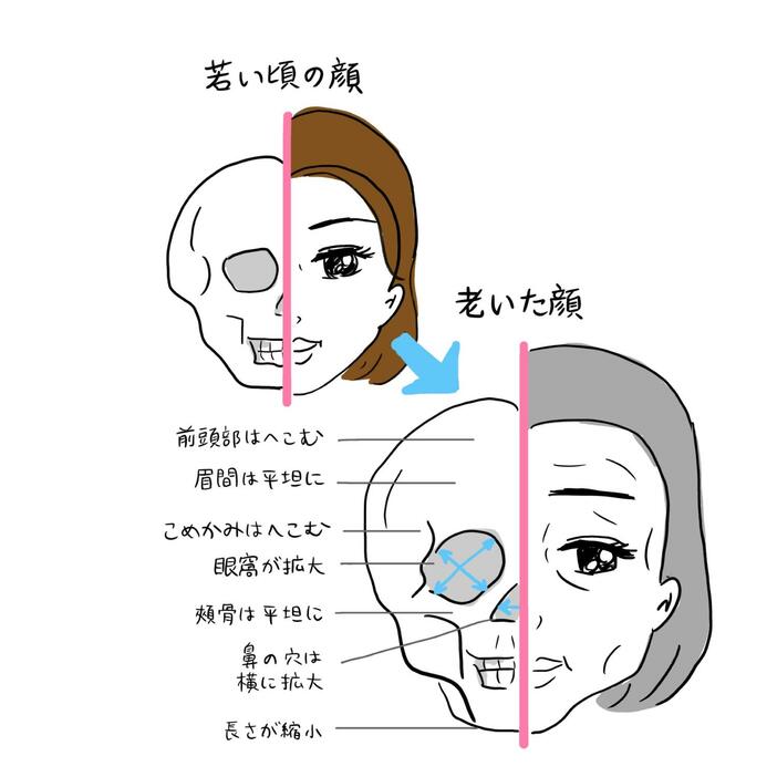 顔面が骨やせすると、この図のような変化が起き、老け顔に