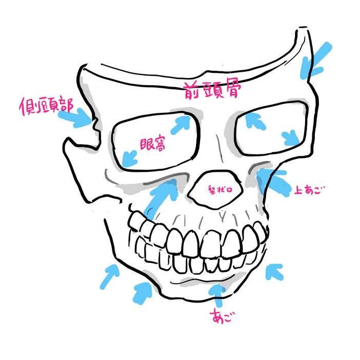 顔面の骨やせにより、額やこめかみはへこみ、眉間は平坦に、眼窩は拡大して目が落ちくぼみやすく。鼻は平らになり低くなっていくうえ、上顎骨が痩せることでほうれい線やゴルゴラインが目立つようにも。下顎骨は後退して二重あごにもなりやすくなる