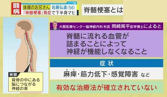 脊髄に流れる血管が詰まり神経が機能しなくなる病