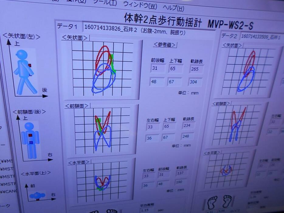 [写真]被検者から送られた信号で解析結果がすぐに表示される