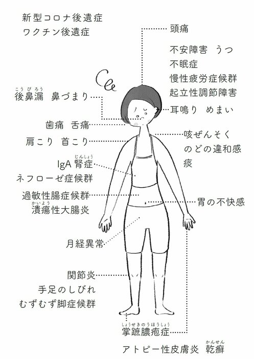 もしかしたらその不調…「慢性上咽頭炎」が原因かも…？（『その不調の原因は慢性上咽頭炎にあった』（扶桑社刊より、以下同）