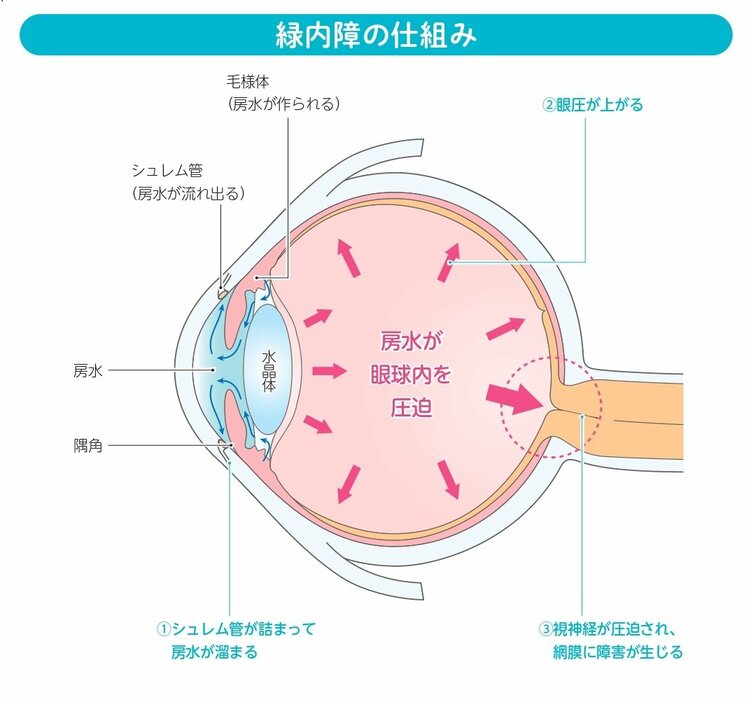 『専門名医が教える！緑内障に効くたった2つの習慣』（扶桑社刊）より