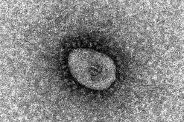新型コロナウイルス・オミクロン株の電子顕微鏡写真（国立感染症研究所提供）
