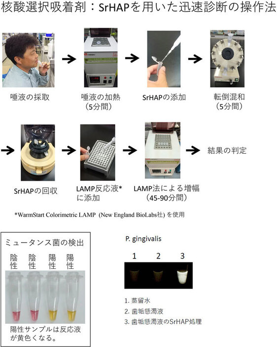 SrHAPを用いた迅速診断の操作法。ミュータンス菌を検出した様子（左下）と、Pg菌を検出した様子（右下）（長嶺憲太郎教授提供の図を基に編集部改編）