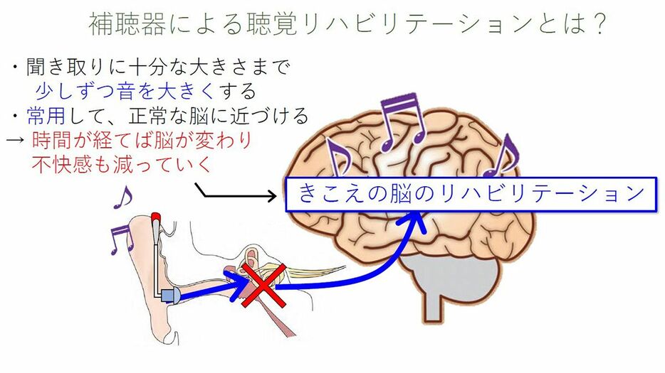 ●補聴器による聴覚リハビリテーションとは？（画像提供：慶應義塾大学病院）