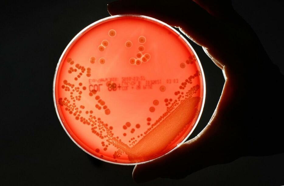 MRSA（メチシリン耐性黄色ブドウ球菌）は、医療現場に広がっている多剤耐性菌で、免疫が低下している人々に致命的な感染症を引き起こす可能性がある。（PHOTOGRAPH BY FABRIZIO BENSCH, REUTERS/REDUX）