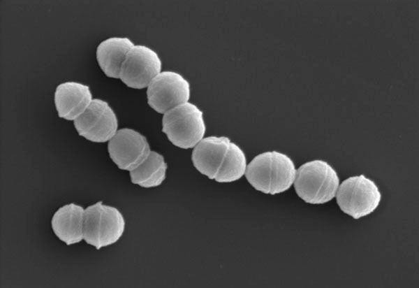 劇症型溶血性レンサ球菌感染症の主な原因となる「A群溶血性レンサ球菌」（国立感染症研究所提供）