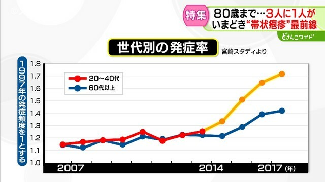 STVニュース北海道