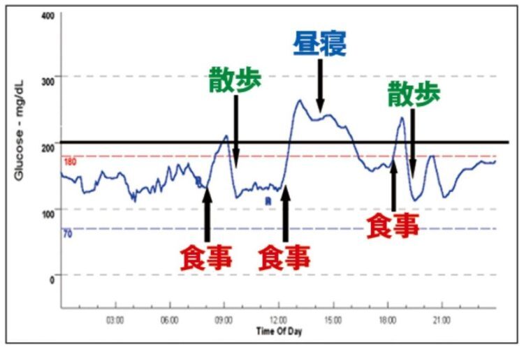 入院直後の1日の血糖の推移