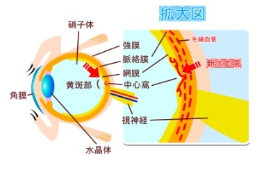 黄斑部とその拡大図