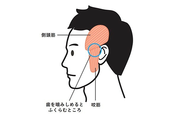 特にこりが強い箇所①　「もみあげ部分」