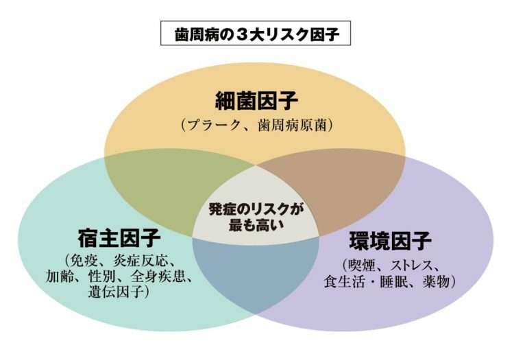 歯周病は、環境や身体の状態が作用して発症・進行する