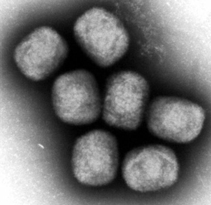 エムポックスウイルスの電子顕微鏡写真（国立感染症研究所提供）