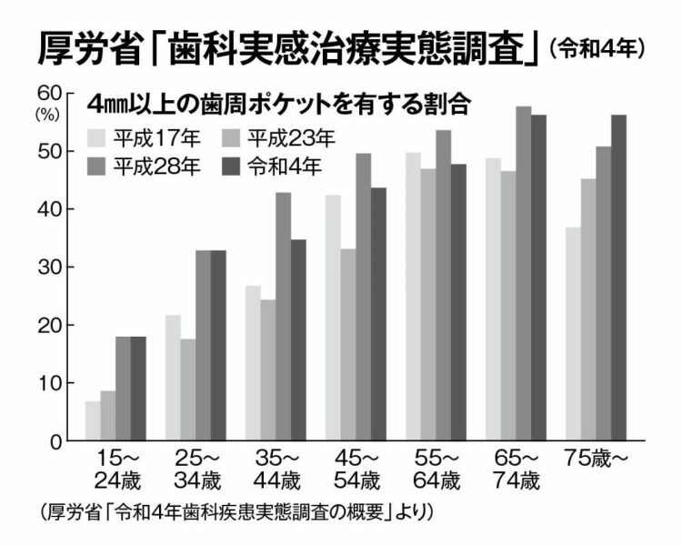 歯周ポケットの深さが4mm以上になると歯周病