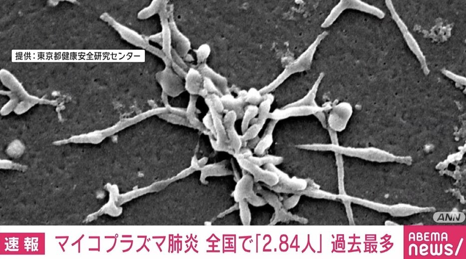 マイコプラズマ肺炎患者数 過去最多を更新