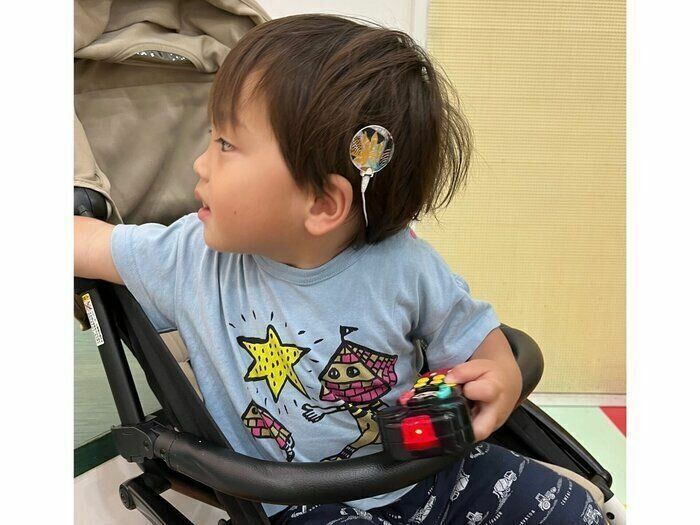 1歳10カ月の糸優くん。人工内耳装置はカラフルでとってもおしゃれ！