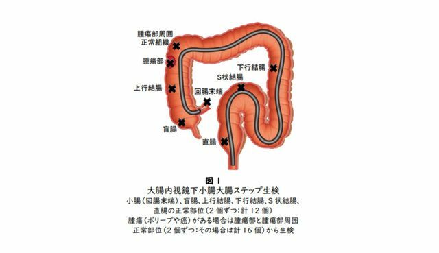 提供：大阪大学