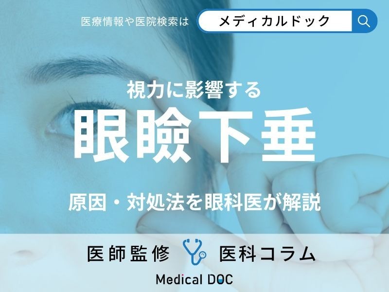 まぶたが視力に影響していることをご存じですか? 「眼瞼下垂」の原因・対処法を眼科医が徹底解説