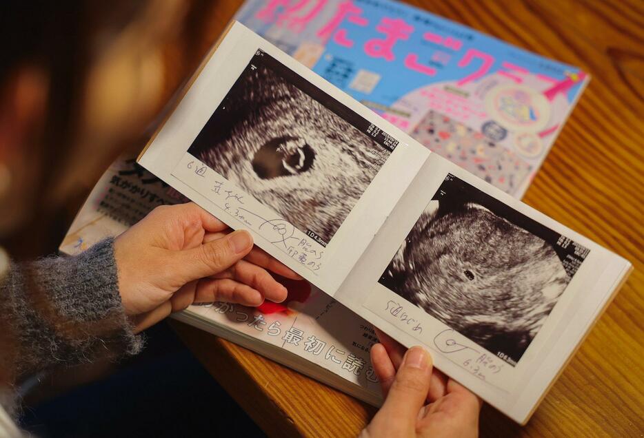 一度はおなかに宿ったわが子の写真。今も宝物だ