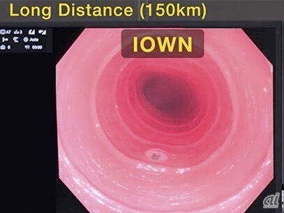 クラウド経由の「内視鏡手術」実現へ--遅延1000分の1秒をNTT実証、医師の違和感ゼロの画像