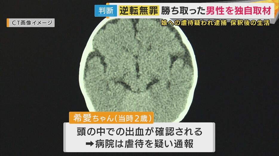 死因は「暴行」か「病死」か