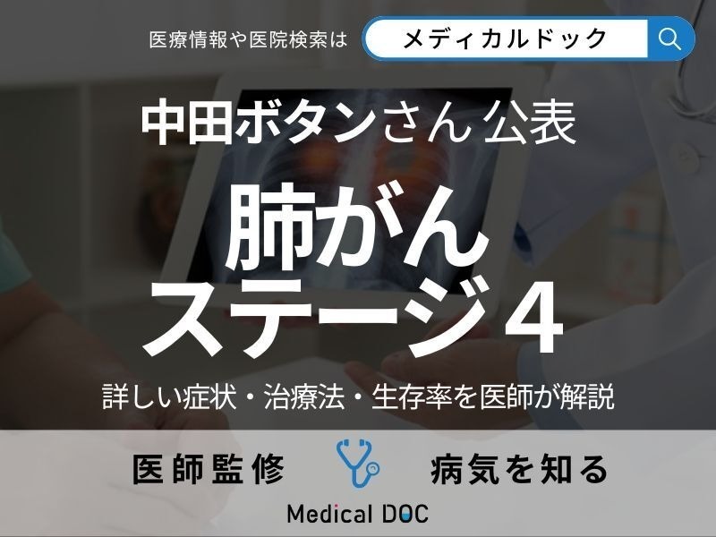 中田ボタンさんが公表「ステージ4の肺がん」 詳しい症状や治療法、生存率を医師が解説