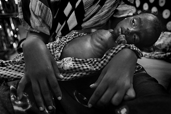 [写真]母親の手に抱かれ、痩せ衰えたソマリアの子供