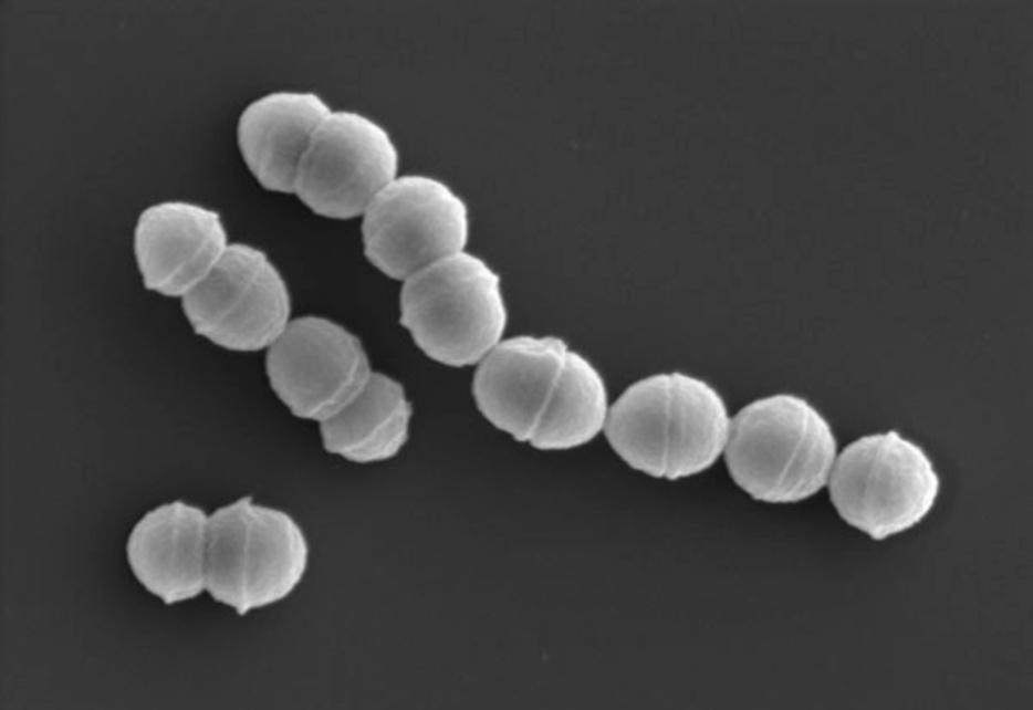 劇症型溶血性レンサ球菌感染症の主な原因となる「A群溶血性レンサ球菌」（国立感染症研究所提供）