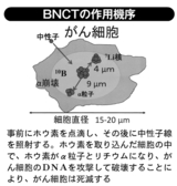 BNCTの作用機序