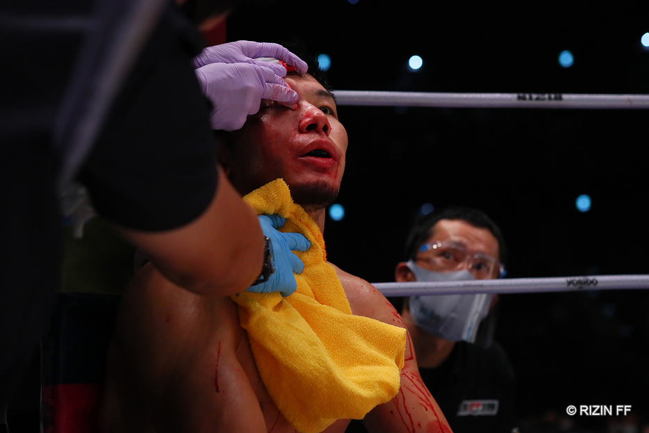 王者の斎藤は右目上を大流血、6、7針の縫合処置が必要だった(写真・RIZIN FF）