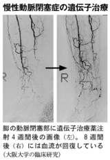 慢性動脈閉塞症発症者に使用