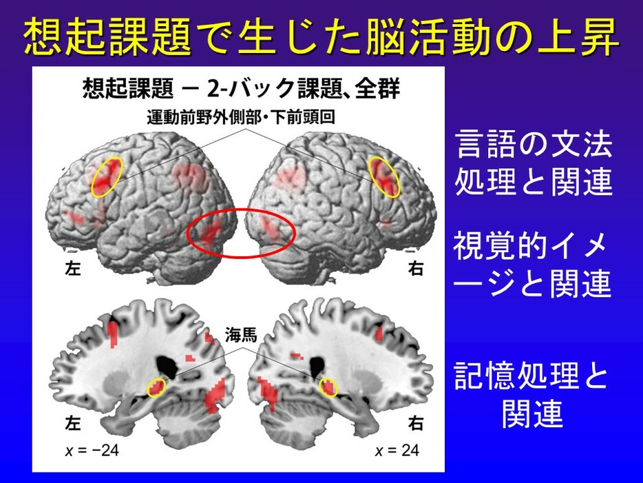 脳の血流が増えた場所が、赤で表されている。言語を扱う運動前野外側部・下前頭回と、記憶の取り出しを担う海馬の脳活動は、紙の手帳を使う方が高かった（提供資料）