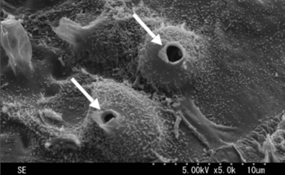 カエル体表におけるカエルツボカビ遊走子嚢の電子顕微鏡写真（麻布大学・宇根有美博士提供）。写真の矢印部分が遊走子の放出管
