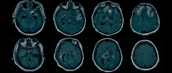 機能的磁気共鳴映像（fMRI）は脳の特定部位が活性化する際に発生する血流変化を探知する手法で脳の活動を映像化する技術だ=コロンビア大学提供