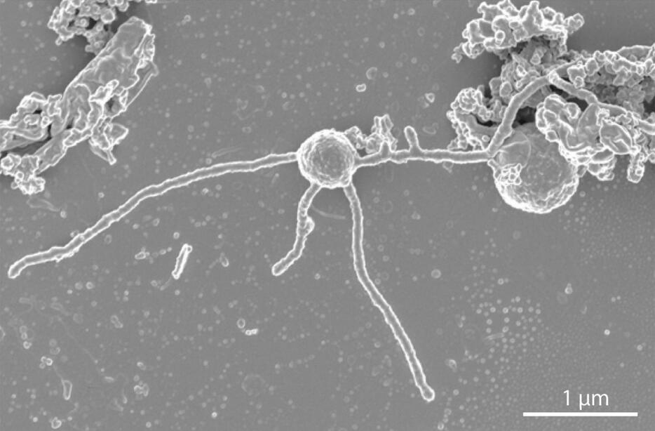 熊野灘の深海で見つかり、新たな「界」として認められた古細菌（海洋研究開発機構提供）