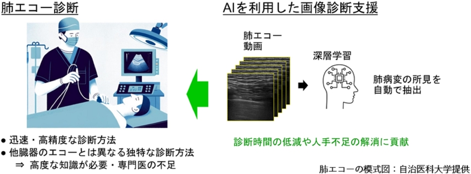 肺エコー対象のAIによる肺病変所見情報の提供の概要