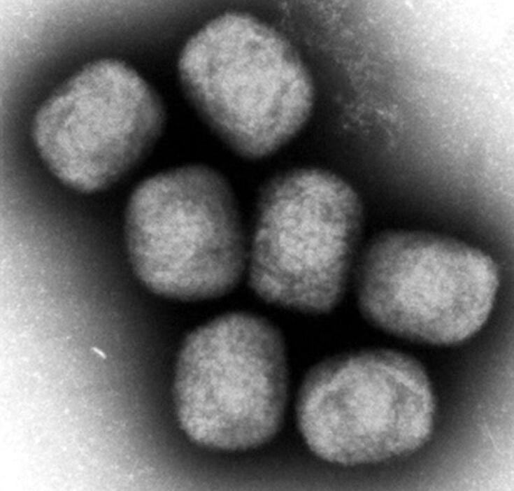 エムポックスウイルスの電子顕微鏡写真（国立感染症研究所提供）