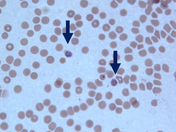 [図3]赤血球中のマラリア原虫（提供：小林望氏）
